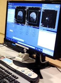 Dr. Aarti Nair acquiring an MRI scan
