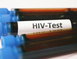 Sample collection for HIV testing
